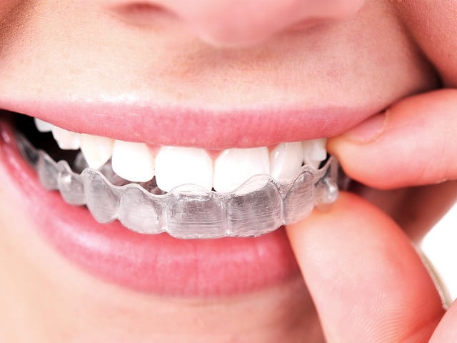 Does Invisalign Work Better Than Braces